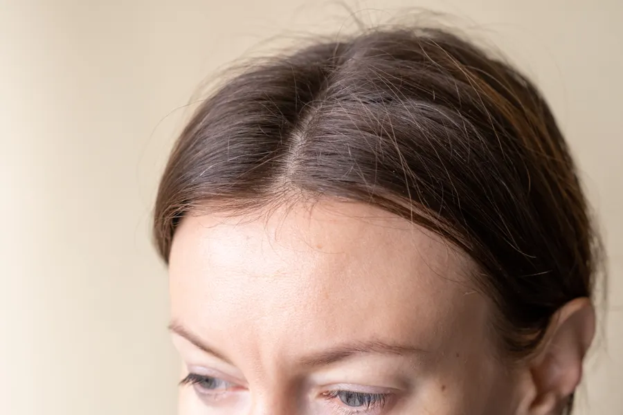 Slightly widened hair part